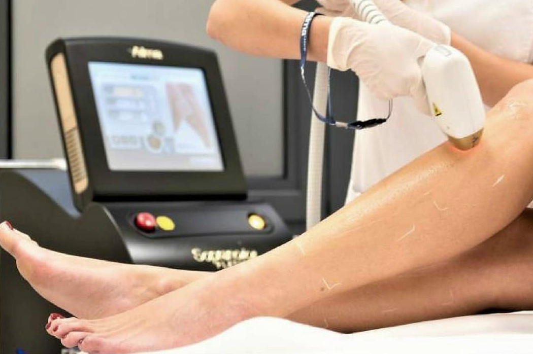 Soprano Laser | Hair Removal Reinvented | Why Choose Alma Lasers